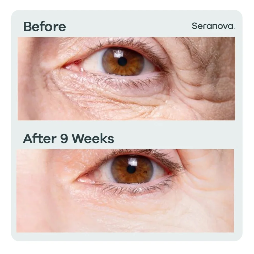 NIB Micro Infusion Patches (Under-Eye Treatment) 4 Pairs/8 patches